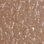 Drebrin Antibody in Immunohistochemistry (Paraffin) (IHC (P))