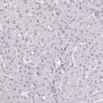 Drebrin Antibody in Immunohistochemistry (Paraffin) (IHC (P))