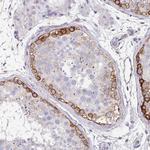 Drebrin Antibody in Immunohistochemistry (Paraffin) (IHC (P))