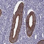 KMO Antibody in Immunohistochemistry (Paraffin) (IHC (P))