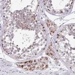 SARS2 Antibody in Immunohistochemistry (Paraffin) (IHC (P))