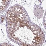 UBE2S Antibody in Immunohistochemistry (Paraffin) (IHC (P))