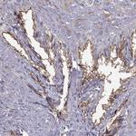 DOG-1 Antibody in Immunohistochemistry (Paraffin) (IHC (P))