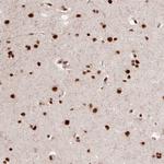 PPIG Antibody in Immunohistochemistry (Paraffin) (IHC (P))