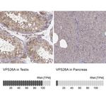 VPS26A Antibody