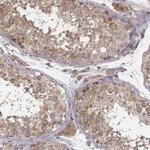 VPS26A Antibody in Immunohistochemistry (Paraffin) (IHC (P))