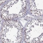 MED26 Antibody in Immunohistochemistry (Paraffin) (IHC (P))