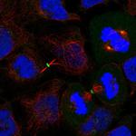 DVL3 Antibody in Immunocytochemistry (ICC/IF)