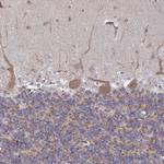 DVL3 Antibody in Immunohistochemistry (Paraffin) (IHC (P))