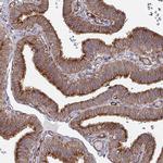 DVL3 Antibody in Immunohistochemistry (Paraffin) (IHC (P))