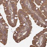 DVL3 Antibody in Immunohistochemistry (Paraffin) (IHC (P))