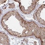 DVL3 Antibody in Immunohistochemistry (Paraffin) (IHC (P))