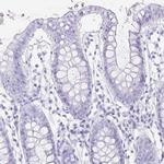 TNNT1 Antibody in Immunohistochemistry (Paraffin) (IHC (P))