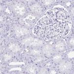 TNNT1 Antibody in Immunohistochemistry (Paraffin) (IHC (P))