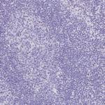 TNNT1 Antibody in Immunohistochemistry (Paraffin) (IHC (P))