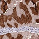 TNNT1 Antibody in Immunohistochemistry (Paraffin) (IHC (P))