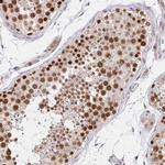 RFC4 Antibody in Immunohistochemistry (Paraffin) (IHC (P))