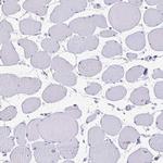 GPX4 Antibody in Immunohistochemistry (Paraffin) (IHC (P))