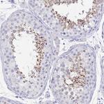 GPX4 Antibody in Immunohistochemistry (Paraffin) (IHC (P))