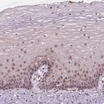 STAT3 Antibody in Immunohistochemistry (Paraffin) (IHC (P))