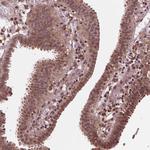 STAT3 Antibody in Immunohistochemistry (Paraffin) (IHC (P))