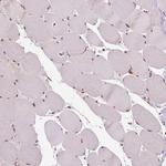 STAT3 Antibody in Immunohistochemistry (Paraffin) (IHC (P))