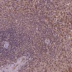 STAT3 Antibody in Immunohistochemistry (Paraffin) (IHC (P))