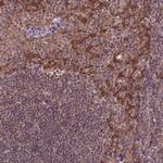 STAT3 Antibody in Immunohistochemistry (Paraffin) (IHC (P))