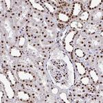 PRP19 Antibody in Immunohistochemistry (Paraffin) (IHC (P))