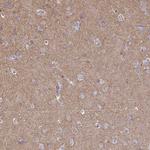 Clathrin Heavy Chain Antibody in Immunohistochemistry (Paraffin) (IHC (P))