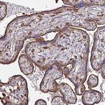 Clathrin Heavy Chain Antibody in Immunohistochemistry (Paraffin) (IHC (P))