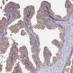 Clathrin Heavy Chain Antibody in Immunohistochemistry (Paraffin) (IHC (P))