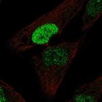 PDX1 Antibody in Immunocytochemistry (ICC/IF)