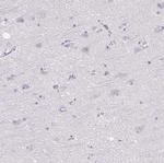 PDX1 Antibody in Immunohistochemistry (Paraffin) (IHC (P))