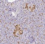 PDX1 Antibody in Immunohistochemistry (Paraffin) (IHC (P))