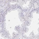 PDX1 Antibody in Immunohistochemistry (Paraffin) (IHC (P))