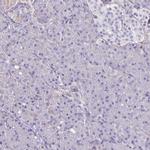 ITGB1 Antibody in Immunohistochemistry (Paraffin) (IHC (P))