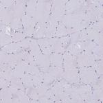 ITGB1 Antibody in Immunohistochemistry (Paraffin) (IHC (P))