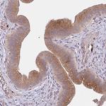 EAP30 Antibody in Immunohistochemistry (Paraffin) (IHC (P))