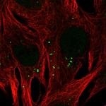 CAPS1 Antibody in Immunocytochemistry (ICC/IF)