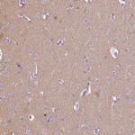 CAPS1 Antibody in Immunohistochemistry (Paraffin) (IHC (P))