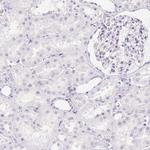 CAPS1 Antibody in Immunohistochemistry (Paraffin) (IHC (P))