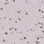 SFRS12 Antibody in Immunohistochemistry (Paraffin) (IHC (P))