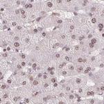 SFRS12 Antibody in Immunohistochemistry (Paraffin) (IHC (P))