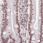 SFRS12 Antibody in Immunohistochemistry (Paraffin) (IHC (P))