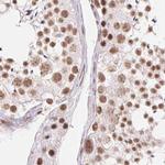 SFRS12 Antibody in Immunohistochemistry (Paraffin) (IHC (P))