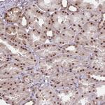 NMNAT1 Antibody in Immunohistochemistry (Paraffin) (IHC (P))