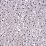 NMNAT1 Antibody in Immunohistochemistry (Paraffin) (IHC (P))