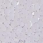 NMNAT1 Antibody in Immunohistochemistry (Paraffin) (IHC (P))