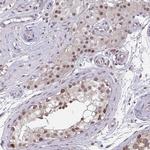 NMNAT1 Antibody in Immunohistochemistry (Paraffin) (IHC (P))